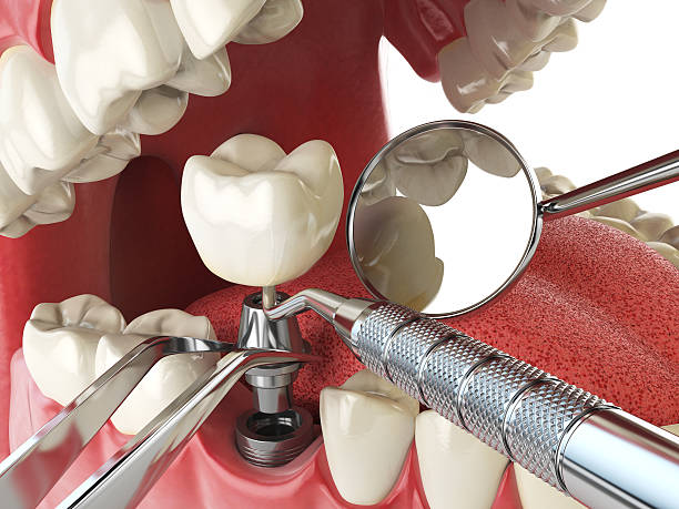 Best Emergency Treatment for Oral Infections in Hereford, TX